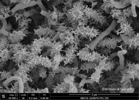 Saccharopolyspora spinosa observada en el microscopio electr�nico